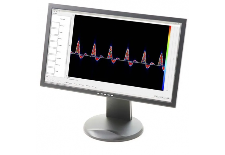 Dopplex® Vascular Reporter Software