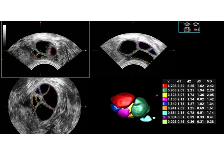 Diagnostic Ultrasound Machines