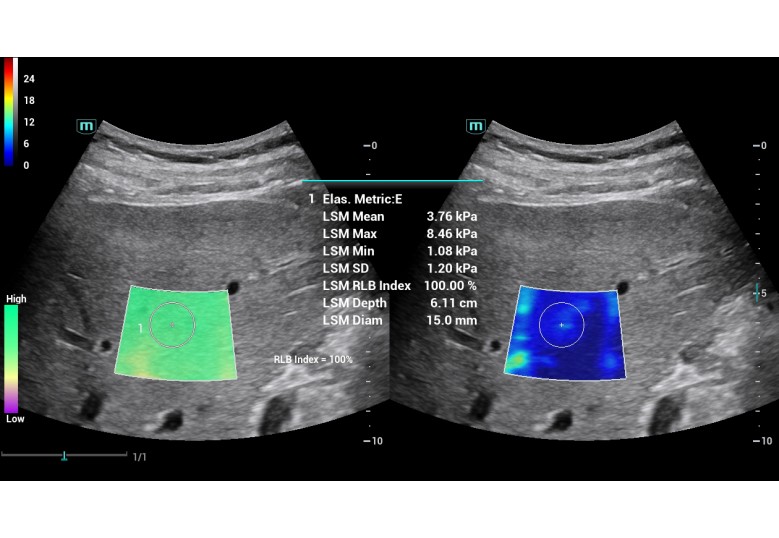Diagnostic Ultrasound Machines