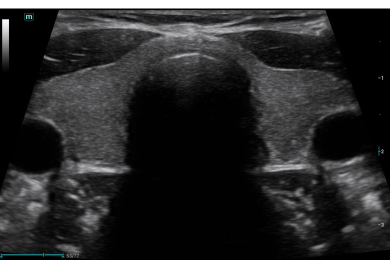 Diagnostic Ultrasound Machines