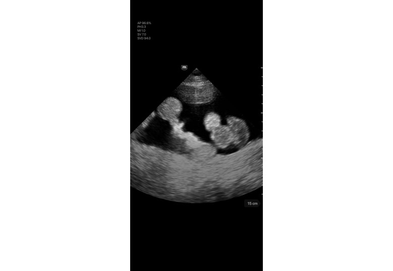 Diagnostic Ultrasound Machines