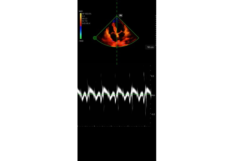 Diagnostic Ultrasound Machines