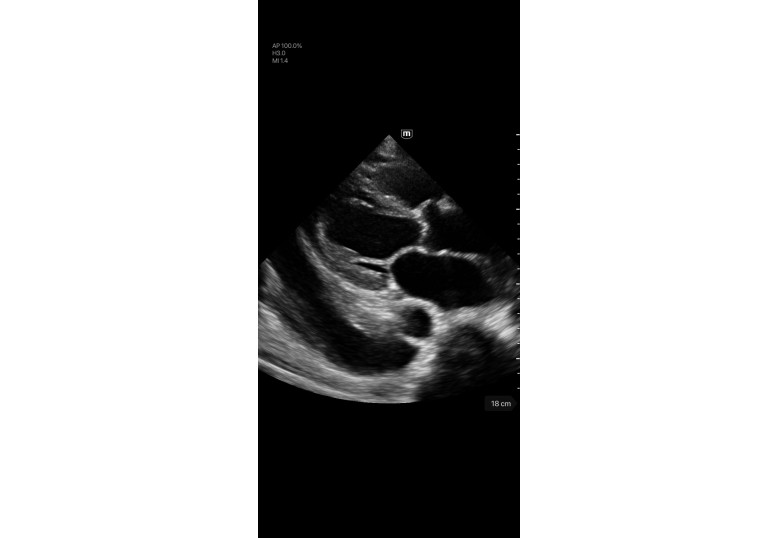 Diagnostic Ultrasound Machines
