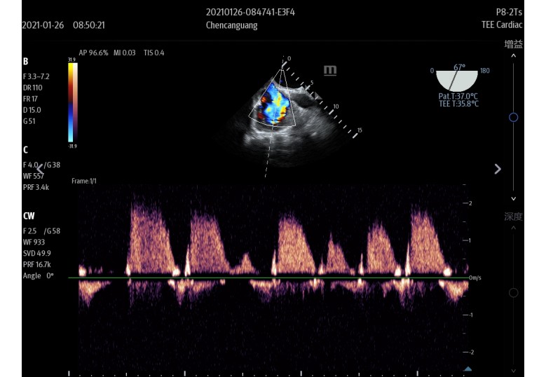Diagnostic Ultrasound Machines