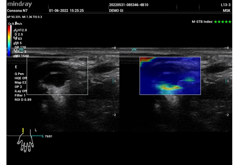 Diagnostic Ultrasound Machines