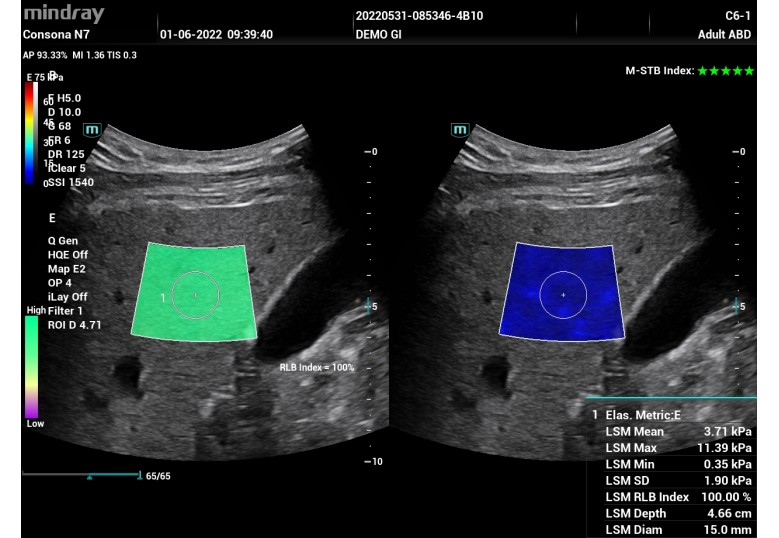 Diagnostic Ultrasound Machines