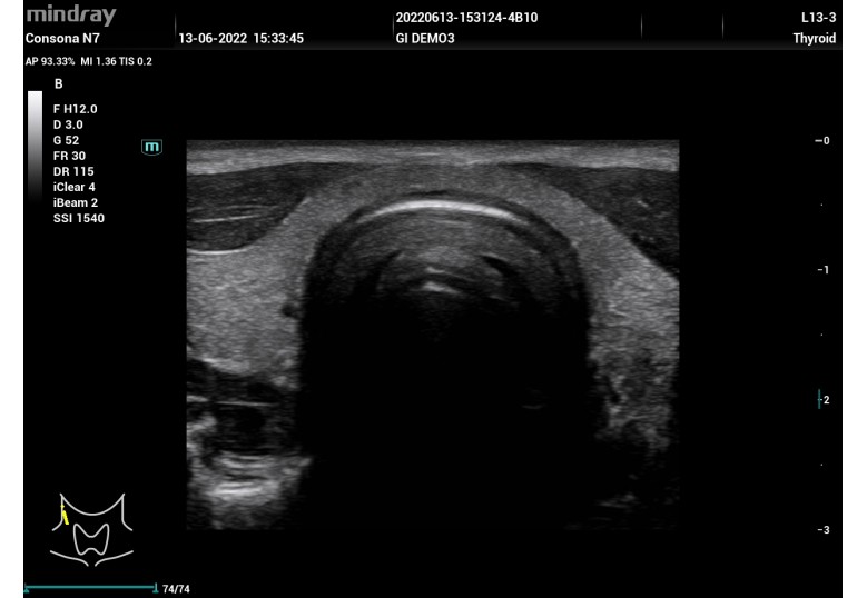 Diagnostic Ultrasound Machines