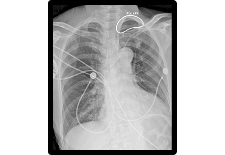 Digital Radiography