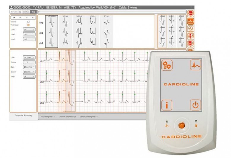ECG
