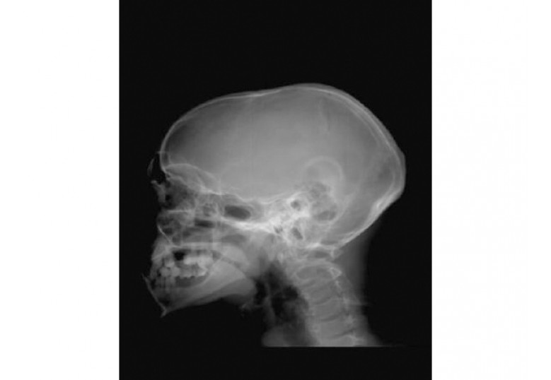 Digital Radiography