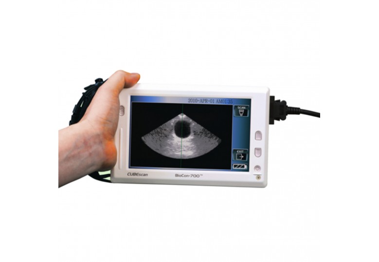 Bladder Scanner