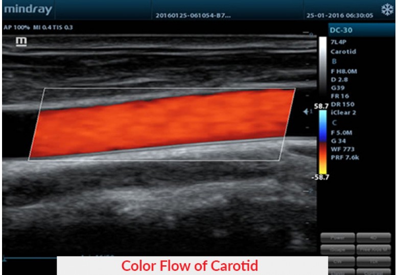 Diagnostic Ultrasound Machines