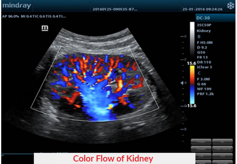Diagnostic Ultrasound Machines