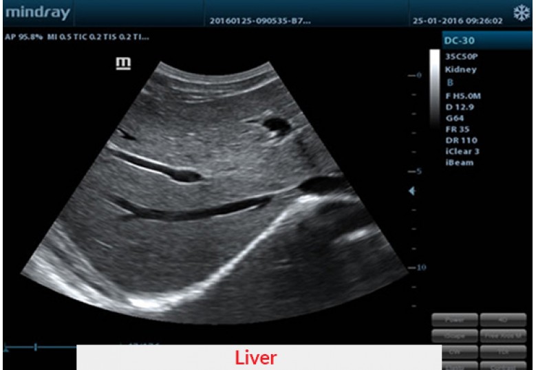 Diagnostic Ultrasound Machines