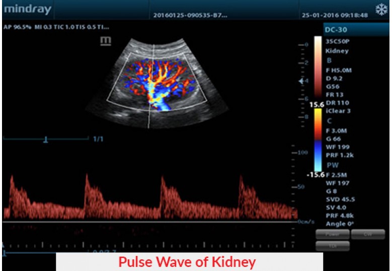 Diagnostic Ultrasound Machines