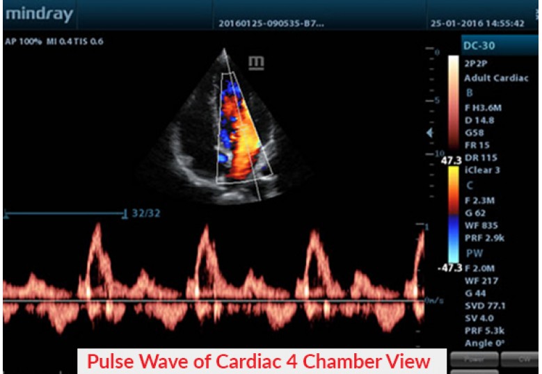 Diagnostic Ultrasound Machines