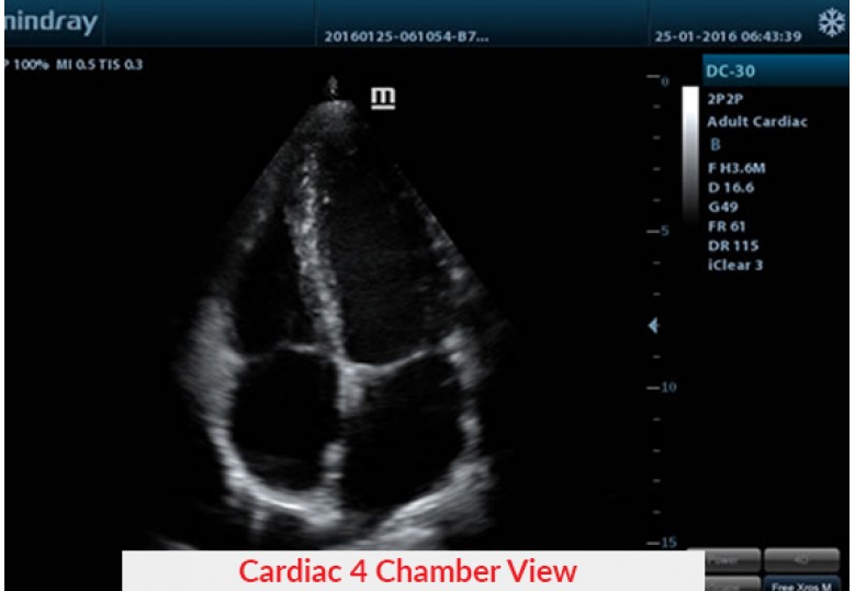 Diagnostic Ultrasound Machines