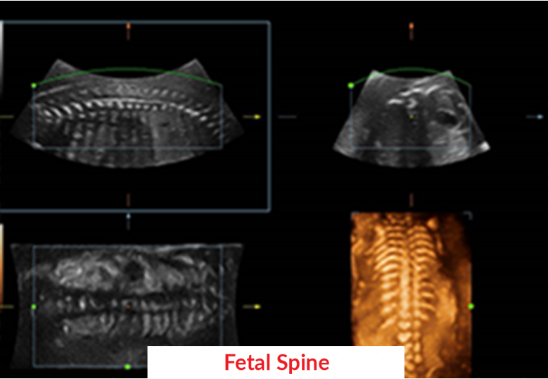 Diagnostic Ultrasound Machines
