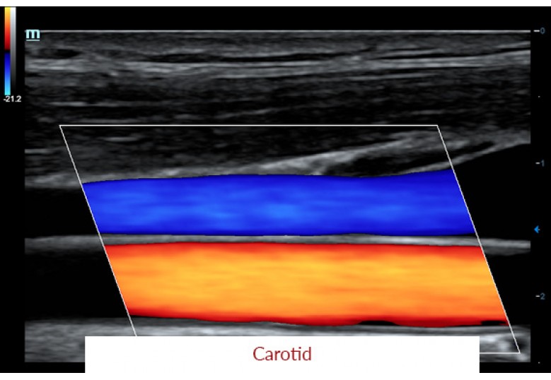 Diagnostic Ultrasound Machines