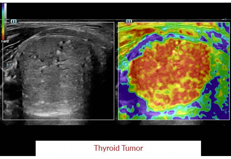 Diagnostic Ultrasound Machines
