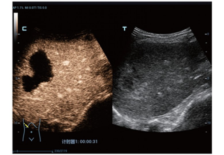 Diagnostic Ultrasound Machines