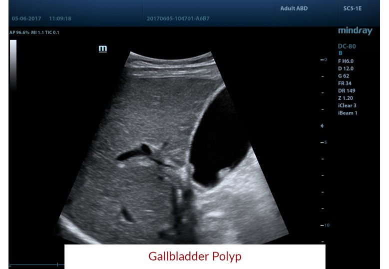 Diagnostic Ultrasound Machines