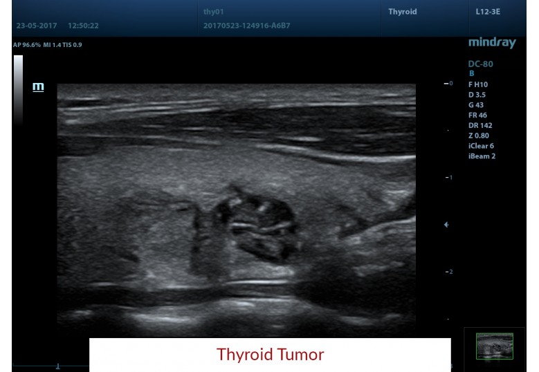 Diagnostic Ultrasound Machines