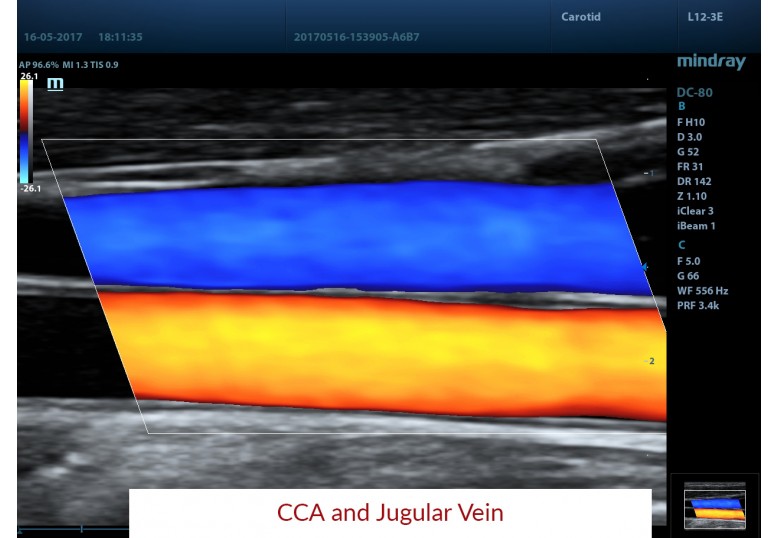 Diagnostic Ultrasound Machines