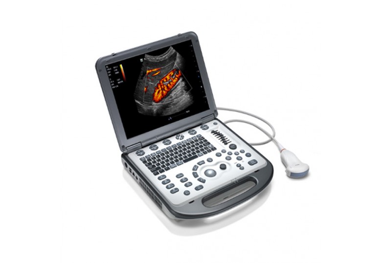 Mindray M6 Ultrasound System (General Imaging)
