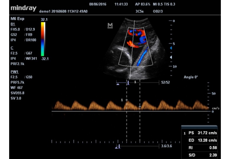 Diagnostic Ultrasound Machines