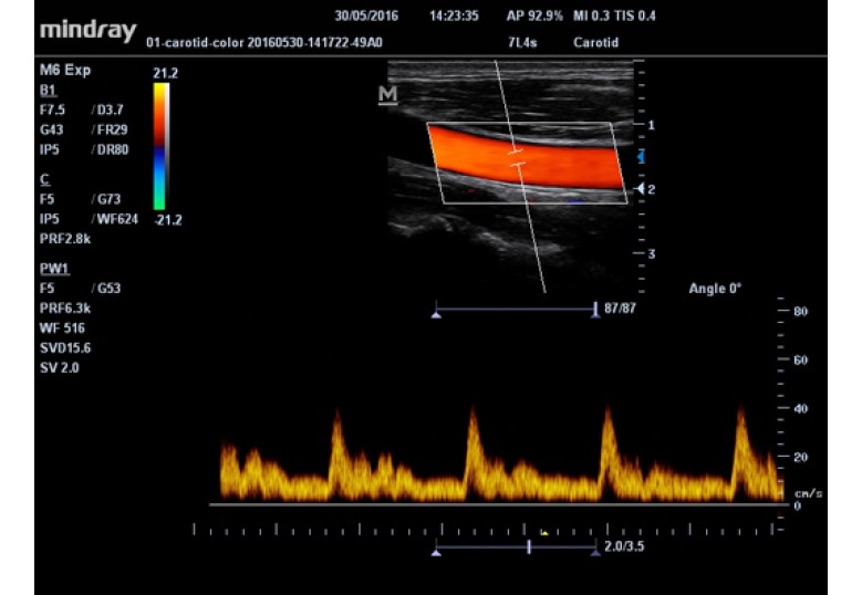 Diagnostic Ultrasound Machines