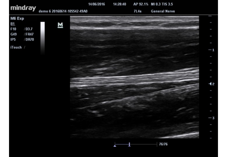 Diagnostic Ultrasound Machines
