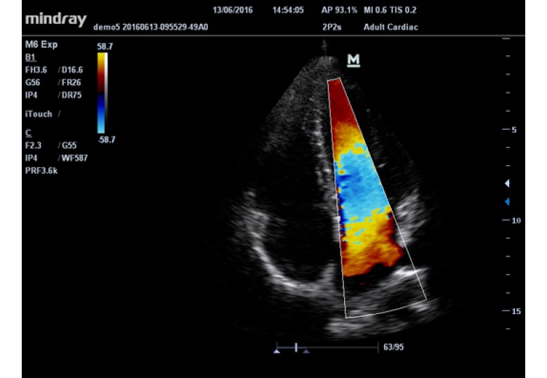 Diagnostic Ultrasound Machines