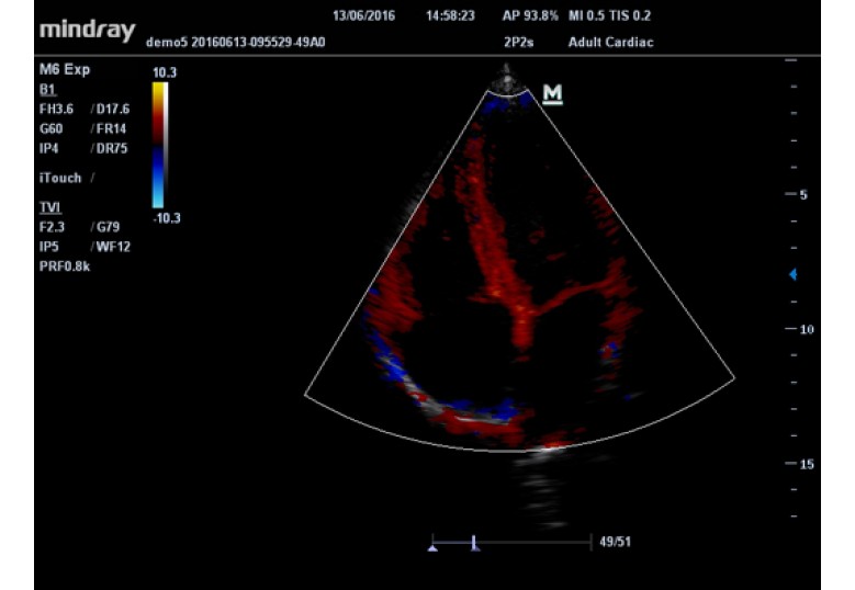 Diagnostic Ultrasound Machines