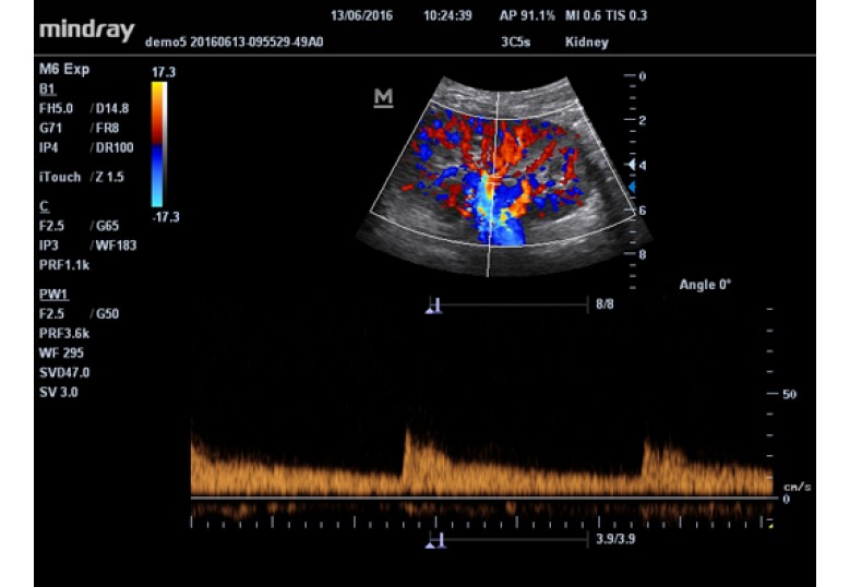 Diagnostic Ultrasound Machines