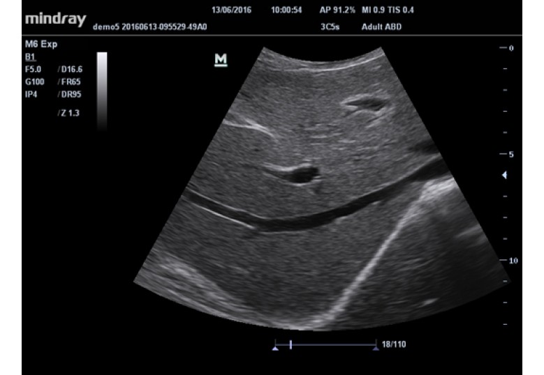 Diagnostic Ultrasound Machines