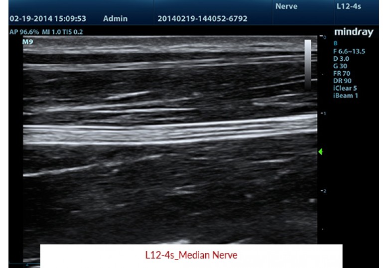 Diagnostic Ultrasound Machines