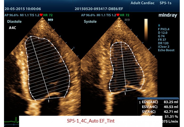 Diagnostic Ultrasound Machines