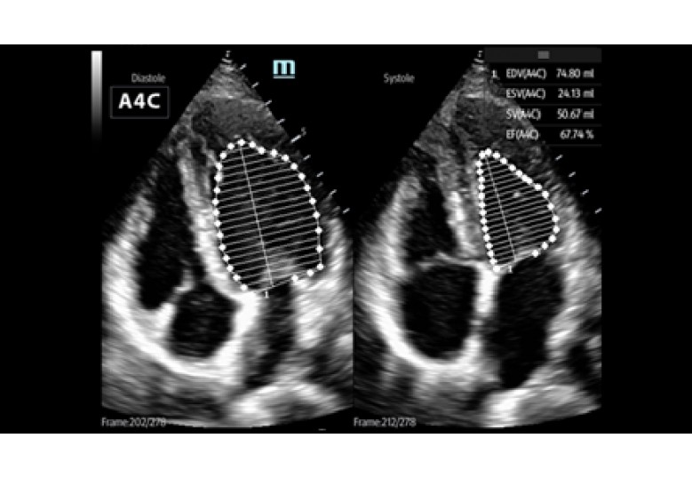 Diagnostic Ultrasound Machines