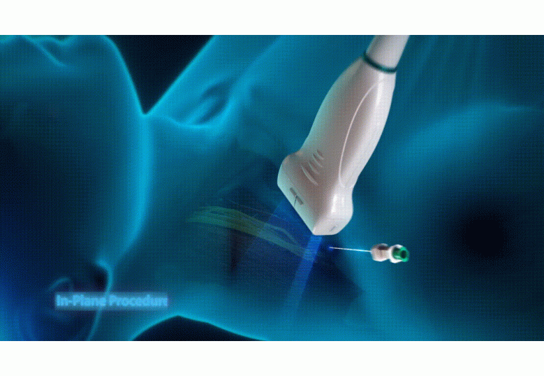 Diagnostic Ultrasound Machines