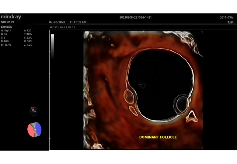 Diagnostic Ultrasound Machines