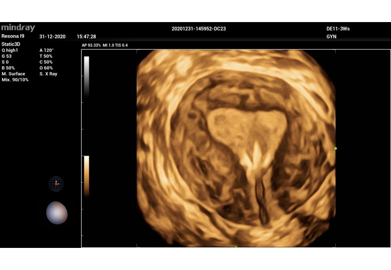 Diagnostic Ultrasound Machines