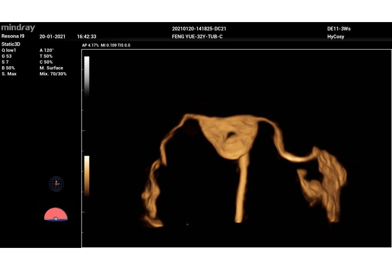 Diagnostic Ultrasound Machines
