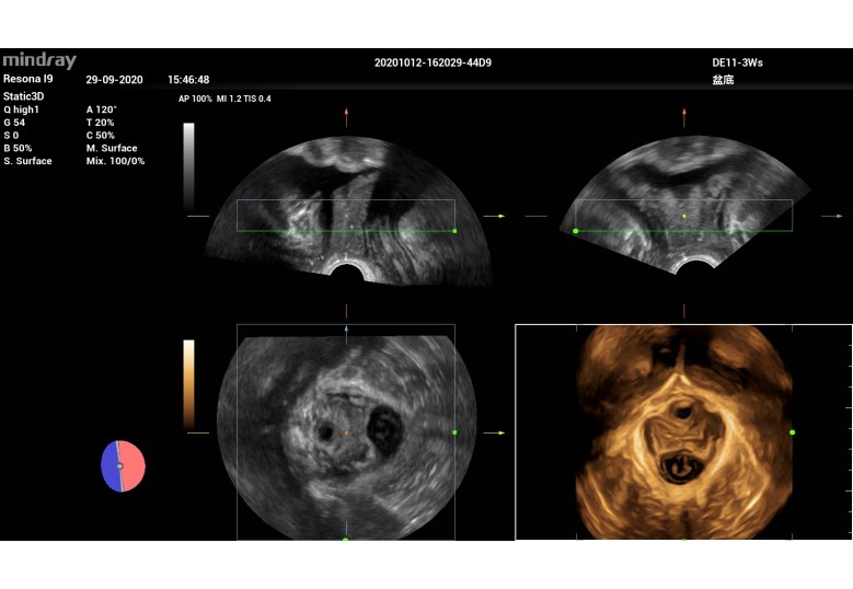 Diagnostic Ultrasound Machines