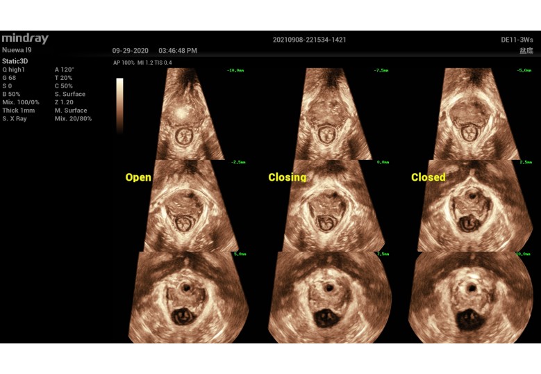 Diagnostic Ultrasound Machines