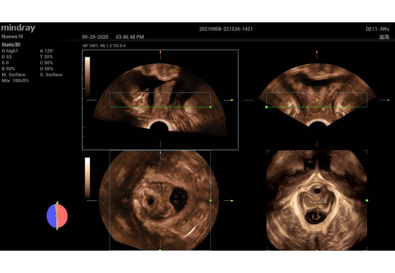 Diagnostic Ultrasound Machines