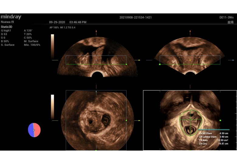 Diagnostic Ultrasound Machines