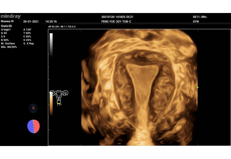Diagnostic Ultrasound Machines