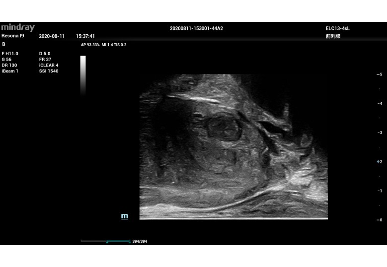 Diagnostic Ultrasound Machines