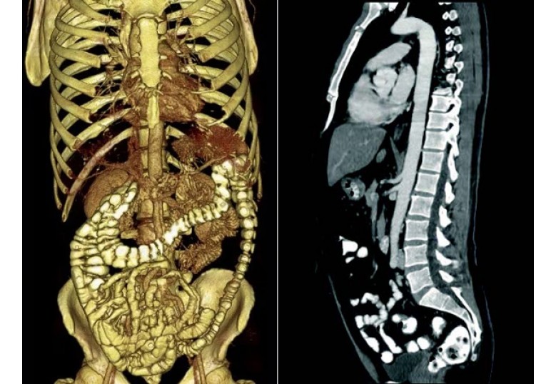 CT Imaging